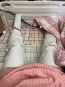 미래여성병원 제왕절개 혈전예방 기구